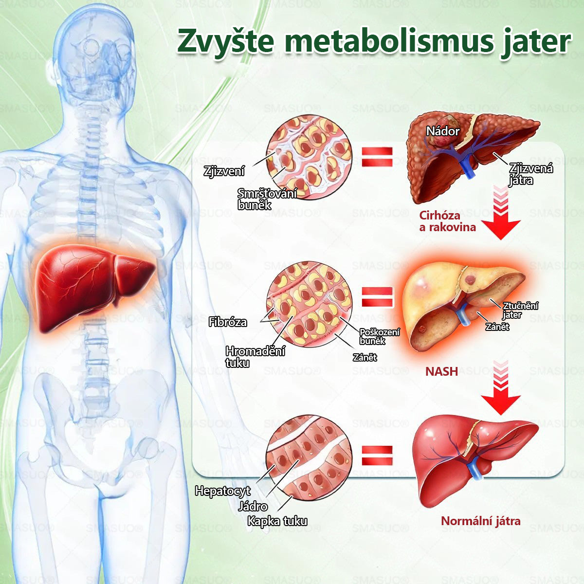 B🇭🇺Európai egészségügyi előírásoknak megfelelő · 👩‍⚕️Orvosi szakértők által ajánlott termék| 🎁 SM𝗔𝗦𝗨O® Glumasetide 8 az 1-ben Karcsú és Egészséges Nano Mikrotűs Tapasz
