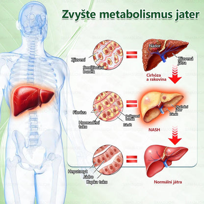 B🇭🇺Európai egészségügyi előírásoknak megfelelő · 👩‍⚕️Orvosi szakértők által ajánlott termék| 🎁 SM𝗔𝗦𝗨O® Glumasetide 8 az 1-ben Karcsú és Egészséges Nano Mikrotűs Tapasz