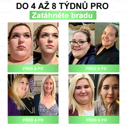 B🇭🇺Európai egészségügyi előírásoknak megfelelő · 👩‍⚕️Orvosi szakértők által ajánlott termék| 🎁 SM𝗔𝗦𝗨O® Glumasetide 8 az 1-ben Karcsú és Egészséges Nano Mikrotűs Tapasz