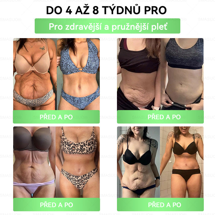 B🇭🇺Európai egészségügyi előírásoknak megfelelő · 👩‍⚕️Orvosi szakértők által ajánlott termék| 🎁 SM𝗔𝗦𝗨O® Glumasetide 8 az 1-ben Karcsú és Egészséges Nano Mikrotűs Tapasz