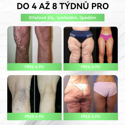 B🇭🇺Európai egészségügyi előírásoknak megfelelő · 👩‍⚕️Orvosi szakértők által ajánlott termék| 🎁 SM𝗔𝗦𝗨O® Glumasetide 8 az 1-ben Karcsú és Egészséges Nano Mikrotűs Tapasz